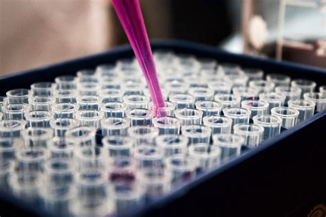 protein content measurement methods